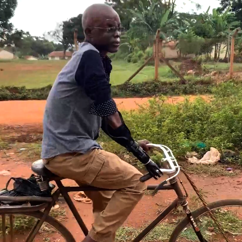 A man rides a bicycle along a dirt path in a rural area. He is wearing a long-sleeved shirt and pants, with a prosthetic arm visible on his left side, gripping the handlebar. The man appears focused, demonstrating how the prosthetic arm allows him to engage in everyday activities.