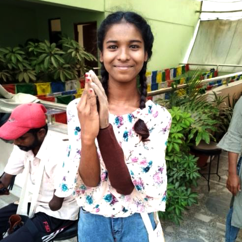 A young girl with a prosthetic hand proudly holds her hands together, smiling as she stands outdoors. The image showcases the positive impact of the Prosthetic Hand Project, emphasizing how the prosthetic hand has given the girl greater mobility and independence.